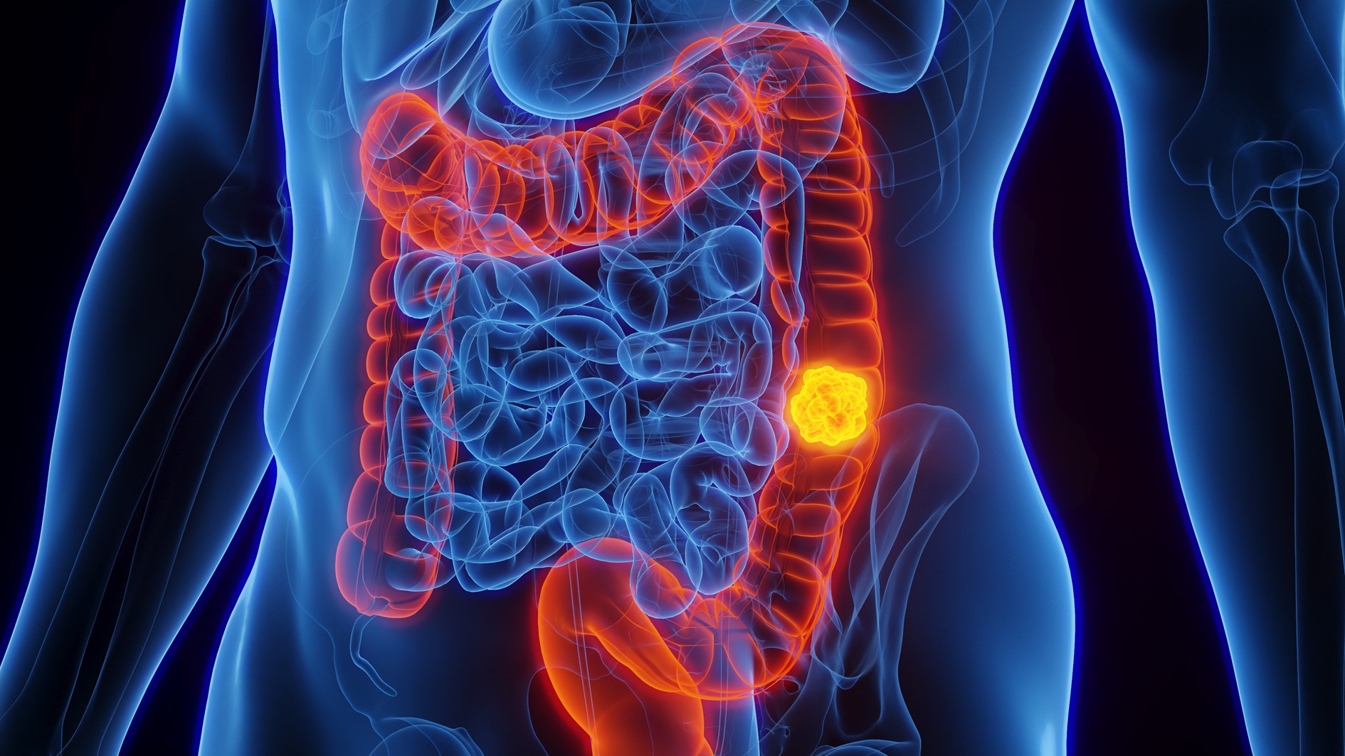 Des scientifiques identifient des cellules immunitaires �� l��origine de cancers